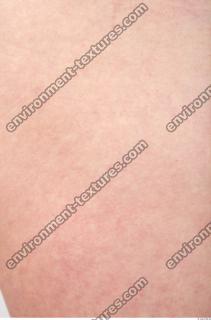 photo texture of white skin 0044